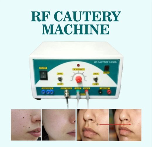 Dermateec RF Cautery Machine — RF cautery by Dermateec
